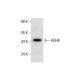 ADH8 Antibody (F-9) - Western Blotting - Image 287990 
