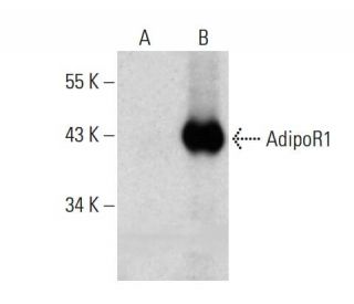 western blotting image from recommended AdipoR1 (D-9) monoclonal antibody replacement. Image 386949