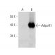 western blotting image from recommended AdipoR1 (D-9) monoclonal antibody replacement. Image 386949