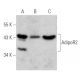 Cet anticorps polyclonal n'est plus commercialisé. Voir l'anticorps monoclonal <a href="adipor2-antibody-a-3">AdipoR2 (A-3)</a> que nous recommandons (données d'échantillonnage indiquées). western blotting image from recommended AdipoR2 (A-3) monoclonal antibody replacement. Image 354854