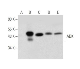 ADK Antibody (H-6) - Western Blotting - Image 324742