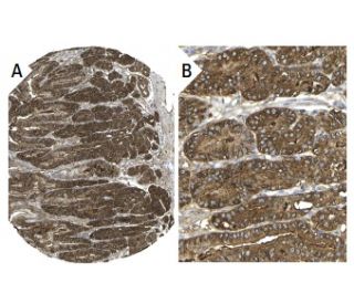 immunohistochemistry image from recommended ADM (HTA171/E8) monoclonal antibody replacement. Image 37613