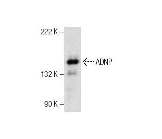 ADNP Antibody (F-9) - Western Blotting - Image 157724 