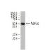 ADPGK Antibody (AA40) - Western Blotting - Image 34125 