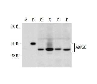 ADPGK Antibody (AA40) - Western Blotting - Image 153658 