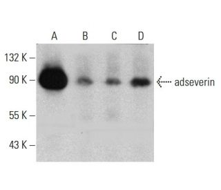 adseverin Antibody (C-2) - Western Blotting - Image 384470 