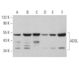 ADSL Antibody (C-11) - Western Blotting - Image 366293 