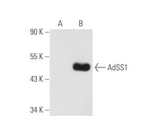 AdSS1 Antibody (H-2) - Western Blotting - Image 80694