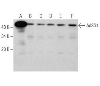 AdSS1 Antibody (G-9) - Western Blotting - Image 384401
