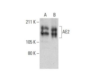 western blotting image from recommended AE2 (D-3) monoclonal antibody replacement. Image 289967
