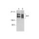 western blotting image from recommended AE2 (D-3) monoclonal antibody replacement. Image 289967