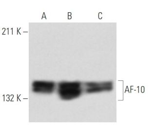 AF-10 Antibody (HAF10 10D3/8) - Western Blotting - Image 12963