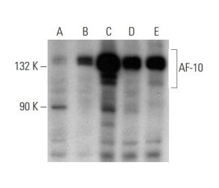 AF-10 Antibody (HAF10 9A5/2) - Western Blotting - Image 136528 