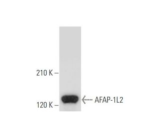 AFAP-1L2 Antibody (12) - Western Blotting - Image 333826 