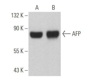 AFP/Alpha fetoprotein Antibody (39) - Western Blotting - Image 361848 
