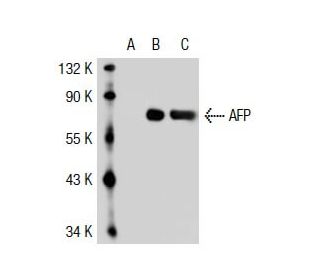 AFP/Alpha fetoprotein Antibody (1B10) - Western Blotting - Image 35113 