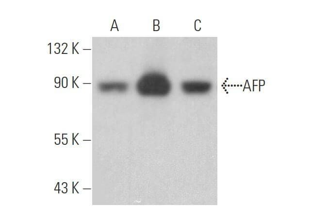 AFP/Alpha fetoprotein抗体 (39) | SCBT - Santa Cruz Biotechnology