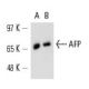 AFP/Alpha fetoprotein Antibody (AFP-11) - Western Blotting - Image 13902 