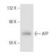 AFP/Alpha fetoprotein Antibody (AFP-11) - Western Blotting - Image 35102