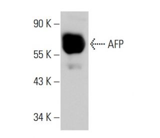 AFP/Alpha fetoprotein Antibody (AFP05) - Western Blotting - Image 19555