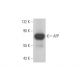 This polyclonal antibody has been discontinued. See our recommended <a href="afp-antibody-c3">AFP/Alpha fetoprotein (C3)</a> monoclonal antibody (sample data shown). western blotting image from recommended AFP/Alpha fetoprotein (C3) monoclonal antibody replacement. Image 352745