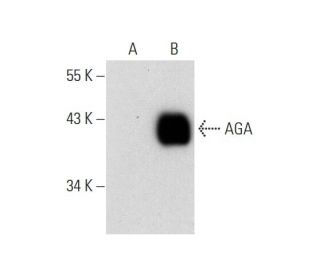AGA Antibody (G-10) - Western Blotting - Image 145522
