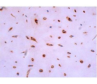 immunohistochemistry image from recommended aggrecan (4F4) monoclonal antibody replacement. Image 382986