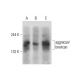 This polyclonal antibody has been discontinued. See our recommended <a href="aggrecan-brevican-antibody-d-4">aggrecan/brevican (D-4)</a> monoclonal antibody (sample data shown). western blotting image from recommended aggrecan/brevican (D-4) monoclonal antibody replacement. Image 127271