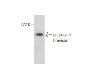 aggrecan/brevican Antibody (D-4) - Western Blotting - Image 300154The Double Nickase Plasmid features a U6 promoter for sgRNA expression, a 20 nt targeting sequence, and a gRNA scaffold to guide Cas9n. It includes a CBh promoter for Cas9n (D10A) and puromycin resistance, GFP for transfection verification, and nuclear localization signals (NLS). The 2A peptide allows co-expression of Cas9n and Puro from a single promoter, enabling precise genome editing with reduced off-target effects.