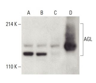 AGL Antibody B 11