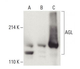 AGL Antibody B 11