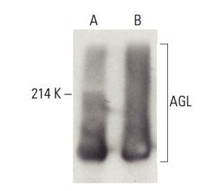 AGL Antibody B 11