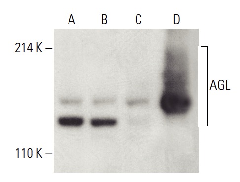 AGL Antibody B 11 SCBT Santa Cruz Biotechnology