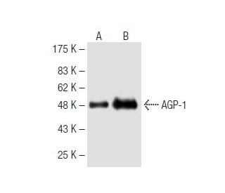 AGP-1 Antibody (29A1) - Western Blotting - Image 62832