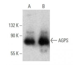 AGPS Antibody (A-2): sc-374201