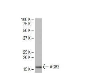AGR2 Antibody (6C5) - Western Blotting - Image 34571 