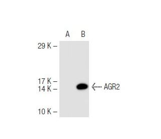 AGR2 Antibody (6C5) - Western Blotting - Image 44788The Double Nickase Plasmid features a U6 promoter for sgRNA expression, a 20 nt targeting sequence, and a gRNA scaffold to guide Cas9n. It includes a CBh promoter for Cas9n (D10A) and puromycin resistance, GFP for transfection verification, and nuclear localization signals (NLS). The 2A peptide allows co-expression of Cas9n and Puro from a single promoter, enabling precise genome editing with reduced off-target effects.