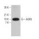 AGR3 Antibody (G-10) - Western Blotting - Image 380793
