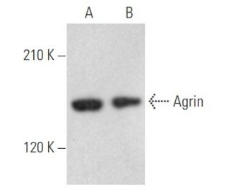 western blotting image from recommended Agrin (D-2) monoclonal antibody replacement. Image 355505