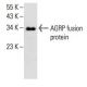AGRP Antibody (H-5) - Western Blotting - Image 393526