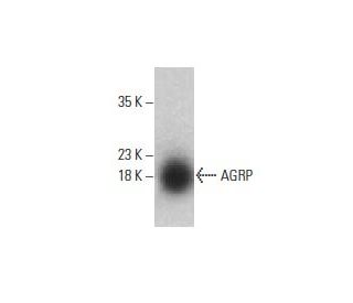 AGRP Antibody (H-5) - Western Blotting - Image 395680 