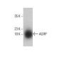 AGRP Antibody (H-5) - Western Blotting - Image 395680 