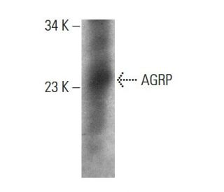 AGRP Antibody (MM0085-32B12) - Western Blotting - Image 376895