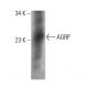 AGRP Antibody (MM0085-32B12) - Western Blotting - Image 376895