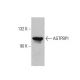 AGTPBP1 Antibody (LM-1A7) - Western Blotting - Image 384047