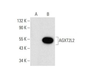 AGXT2L2 Antibody (C-11) - Western Blotting - Image 143536
