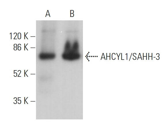 AHCYL1/SAHH-3 Antibody (D-7) | SCBT - Santa Cruz Biotechnology