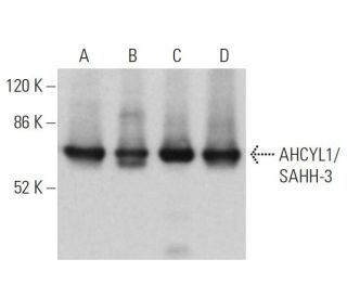 AHCYL1/SAHH-3 Antibody (D-7) - Western Blotting - Image 366846 