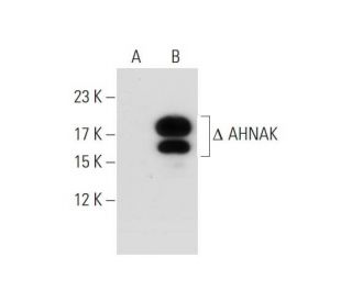 AHNAK Antibody (1G11) - Western Blotting - Image 127873 