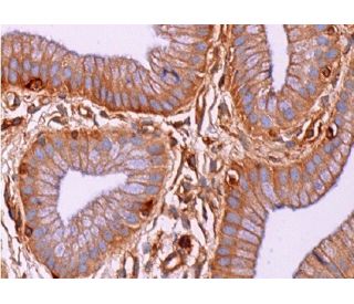 AHNAK Antibody (E-5) - Immunohistochemistry - Image 375177 
